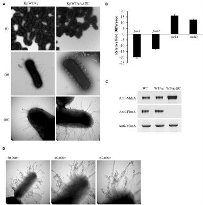 EtcABC, a Putative EII Complex, Regulates Type 3 Fimbriae via CRP-cAMP Signaling in Klebsiella pneumoniae